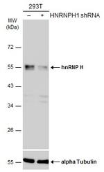 hnRNP H1 Antibody in Western Blot (WB)