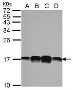 Profilin 1 Antibody in Western Blot (WB)