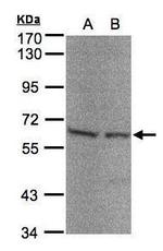 Seryl-tRNA synthetase Antibody in Western Blot (WB)