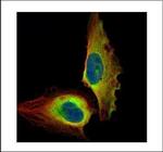 NFkB p65 Polyclonal Antibody