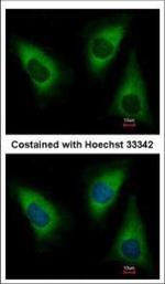 KARS Polyclonal Antibody