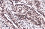 FOXM1 Antibody in Immunohistochemistry (Paraffin) (IHC (P))