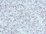 POM121 Antibody in Immunohistochemistry (Paraffin) (IHC (P))
