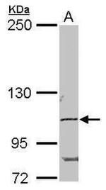 POM121 Antibody in Western Blot (WB)