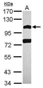 POM121 Antibody in Western Blot (WB)