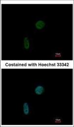 CIZ1 Antibody in Immunocytochemistry (ICC/IF)