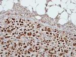 CIZ1 Antibody in Immunohistochemistry (Paraffin) (IHC (P))