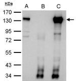 CIZ1 Antibody in Immunoprecipitation (IP)
