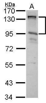 CIZ1 Antibody in Western Blot (WB)