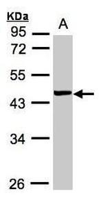 VPS72 Polyclonal Antibody