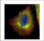 Cofilin Antibody in Immunocytochemistry (ICC/IF)