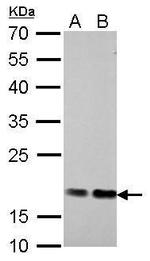 Cofilin Antibody in Western Blot (WB)
