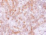 KARS Polyclonal Antibody
