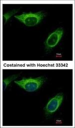 MEK2 Polyclonal Antibody