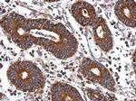 MEK2 Antibody in Immunohistochemistry (Paraffin) (IHC (P))
