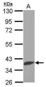 SLC25A1 Antibody in Western Blot (WB)