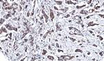 MEK2 Polyclonal Antibody