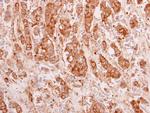 14-3-3 theta Polyclonal Antibody