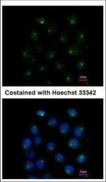 SAR1A Polyclonal Antibody