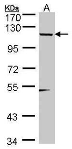TSHZ1 Polyclonal Antibody