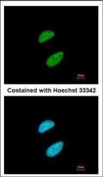 TRIM28 Antibody in Immunocytochemistry (ICC/IF)