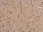 NGFR Antibody in Immunohistochemistry (Paraffin) (IHC (P))