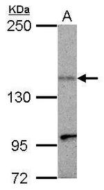 KIF1C Polyclonal Antibody