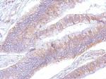 EEF2 Antibody in Immunohistochemistry (Paraffin) (IHC (P))