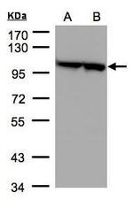EEF2 Antibody in Western Blot (WB)