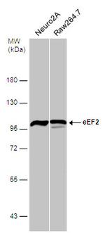 EEF2 Antibody in Western Blot (WB)