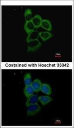 PSMD2 Polyclonal Antibody