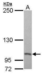 PSMD2 Antibody in Western Blot (WB)