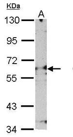 PSMD3 Antibody in Western Blot (WB)
