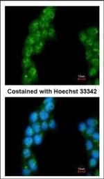 PSMD3 Polyclonal Antibody