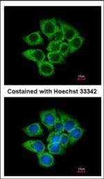 EEF1D Polyclonal Antibody