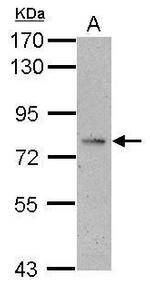 ALS Antibody in Western Blot (WB)