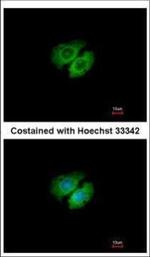 AHA1 Polyclonal Antibody