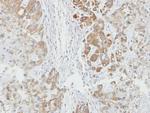 AHA1 Antibody in Immunohistochemistry (Paraffin) (IHC (P))