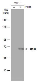 RelB Polyclonal Antibody