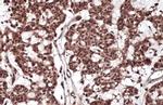 RelB Polyclonal Antibody