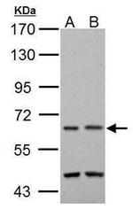 TAK1 Antibody in Western Blot (WB)