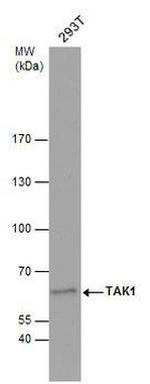TAK1 Antibody in Western Blot (WB)
