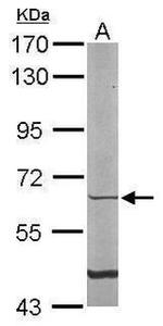 TAK1 Antibody in Western Blot (WB)