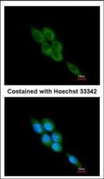 Mu-Calpain Polyclonal Antibody