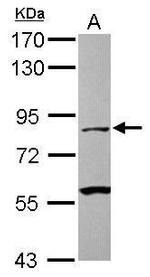 Mu-Calpain Antibody in Western Blot (WB)