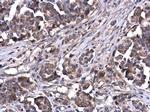 ATG5 Polyclonal Antibody
