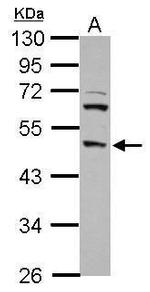 DP2 Antibody in Western Blot (WB)