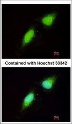 NADE Polyclonal Antibody