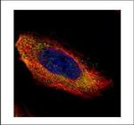 MEK1 Polyclonal Antibody