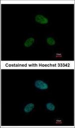 DRAK1 Polyclonal Antibody